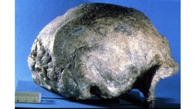 500,000 - 600,000 years Before Present: The Narmada human dies. Geologist Arun Sonakia finds just a skull cap on the banks of the Narmada at Hathnora, a village in Madhya Pradesh, in 1982. It is the only early human (Homo erectus) fossil found in India. From it we know that India was a home, even before the Homo sapiens. (Photo by Arun Sonakia) 500,000 - 600,000 years Before Present: The Narmada human dies. Geologist Arun Sonakia finds just a skull cap on the banks of the Narmada at Hathnora, a village in Madhya Pradesh, in 1982. It is the only early human (Homo erectus) fossil found in India. From it we know that India was a home, even before the Homo sapiens. (Photo by Arun Sonakia)