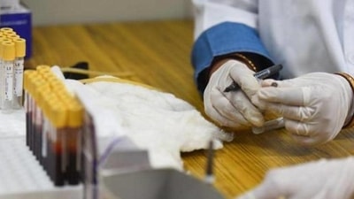Serological surveys are used by epidemiologists to determine the prevalence of a disease in a population.