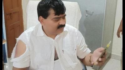 BJP MP Sangaml Lal Gupta after a clash between BJP and Congress activists, in Pratapgarh, Saturday. (PTI Photo) BJP MP Sangaml Lal Gupta after a clash between BJP and Congress activists, in Pratapgarh, Saturday. (PTI Photo)