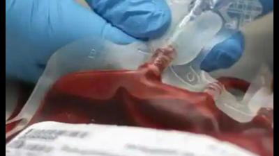The use of this technology will ensure higher safety levels for patients undergoing blood transfusion . (Pic for representation)
