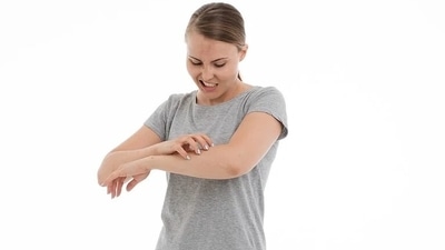 In Ayurveda, a condition called Shitapitta is explained, which is quite similar to urticaria or hives. (Pixabay) In Ayurveda, a condition called Shitapitta is explained, which is quite similar to urticaria or hives. (Pixabay)