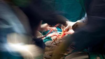 The Phagwara boy underwent a congenital heart surgery for free under the National Child Health Programme. (HT PHOTO)