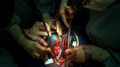 World Health Organisation points out that 63% of Indians suffer from non-communicable diseases of which 27% can be attributed to cardiovascular ailments. (Representational photo / AFP) World Health Organisation points out that 63% of Indians suffer from non-communicable diseases of which 27% can be attributed to cardiovascular ailments. (Representational photo / AFP)