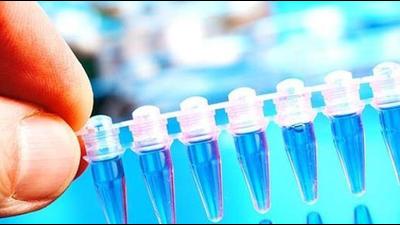 A cohort of 20,006 patients, including 1,566 from India, with 15 types of cancers was followed up for the study. These patients were under treatment in 466 hospitals across 61 countries and had a decision for curative surgery during the pandemic. They were followed up until the point of surgery or till they stopped the follow-up up to August 31, 2020. (REPRESENTATIONAL PIC)