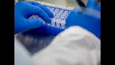 Till now,Uttar Pradesh has tested 8,21,45,330 Covid samples. (Photo for representatio)