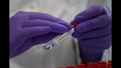 Meanwhile, tricity’s active Covid cases tally stands at 69, with 29 patients still being infected in Chandigarh, 25 in Mohali and 15 in Panchkula. (AP) Meanwhile, tricity’s active Covid cases tally stands at 69, with 29 patients still being infected in Chandigarh, 25 in Mohali and 15 in Panchkula. (AP)