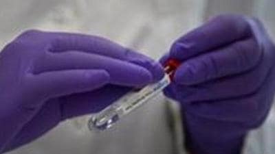 Chandigarh has so far reported 65,335 Covid cases, of which 64,486 have been cured and 820 have died. (AP)