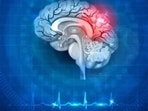 World Stroke Day 2021(Shutterstock)