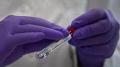 In Chandigarh, the new Covid infections surfaced from Sectors 9, 19, 24, 35 and 52. (AP)