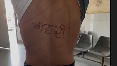 An undertrial prisoner has alleged that the jail superintendent has engraved the word ‘terrorist’ on his back with an iron rod, (Photo: Twitter/@mssirsa)