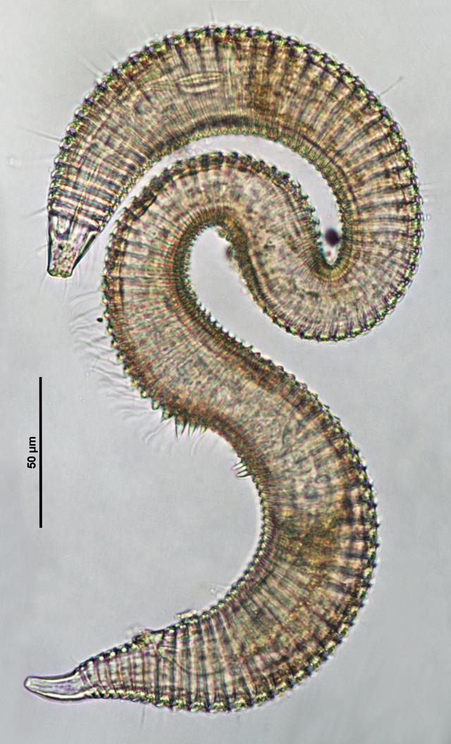 This roundworm is not parasitic. It might actually be quite helpful. It most likely feeds on bacteria and microalgae. (Photo courtesy K Rajmohana) This roundworm is not parasitic. It might actually be quite helpful. It most likely feeds on bacteria and microalgae. (Photo courtesy K Rajmohana)