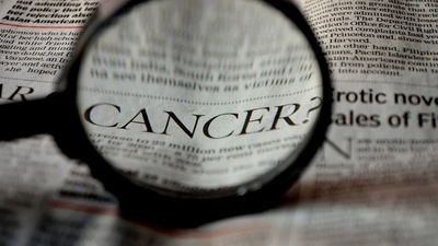 A research collaboration has discovered that cancer invasion and migration can be suppressed in mice by manipulating the stiffness of the cell membrane. (Pixabay) A research collaboration has discovered that cancer invasion and migration can be suppressed in mice by manipulating the stiffness of the cell membrane. (Pixabay)