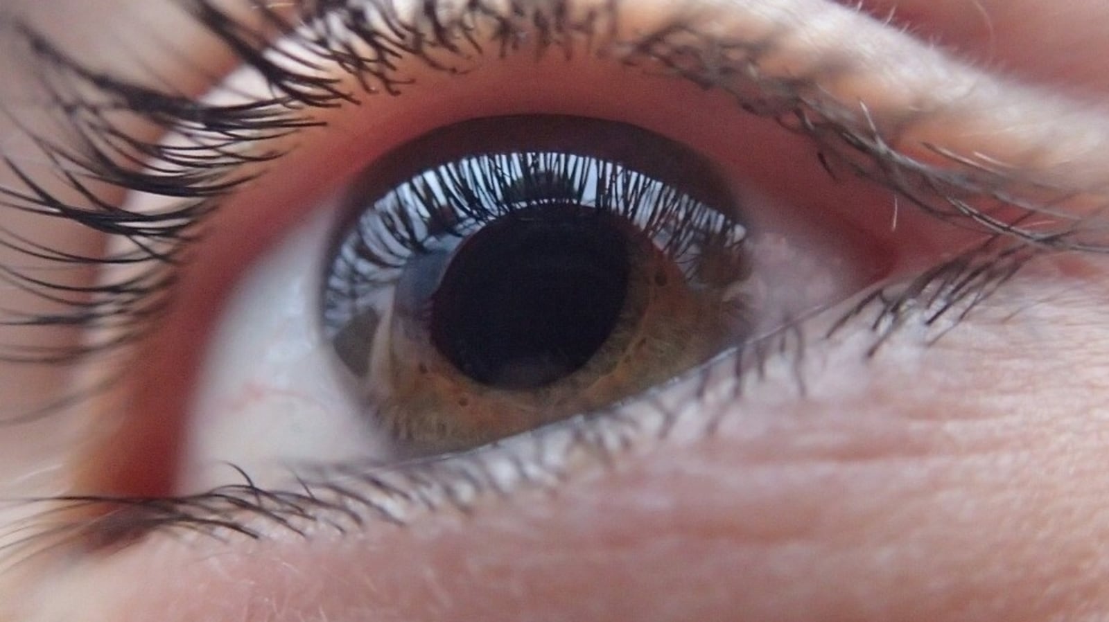 세계 원추각막의 날: 영구적인 시력 상실로 이어질 수 있는 눈 상태에 관한 모든 것 |  건강