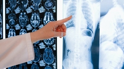 World Pneumonia Day is observed on November 12 (Pexels) World Pneumonia Day is observed on November 12 (Pexels)