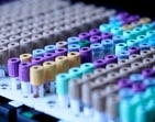A recent study led by Sweden's Lund University has identified a protein in blood that could predict type 2 diabetes up to nineteen years prior to the onset of the disease. A recent study led by Sweden's Lund University has identified a protein in blood that could predict type 2 diabetes up to nineteen years prior to the onset of the disease.