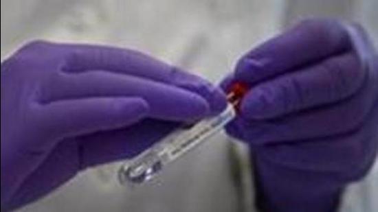 Tricity’s active Covid cases tally stands at 81 with 49 patients still being infected in Mohali, followed by 23 in Chandigarh and only nine in Panchkula. (AP)