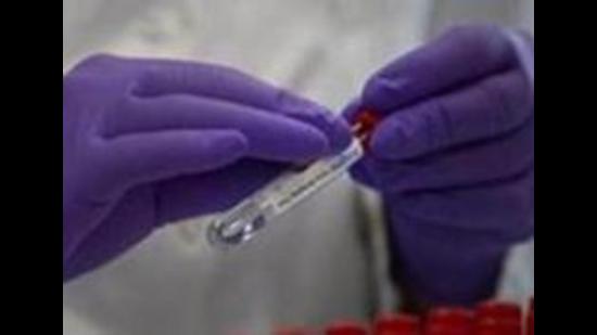 With 69 infections, tricity’s weekly Covid cases were highest in 8 weeks. Cases have increased after the festive season. (AP File Photo/ Representational image)