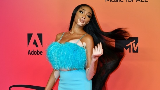 Model Winnie Harlow looks breathtaking in a blue fur crop top, short skirt and mix-match shoes.&nbsp;(REUTERS)