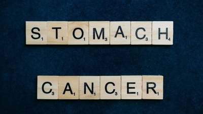 Stomach Cancer Awareness Month: Apart from family history and genetic predisposition, people who consume less fruits and vegetables and more of salty and smoked stuff are at risk. (Pexels) Stomach Cancer Awareness Month: Apart from family history and genetic predisposition, people who consume less fruits and vegetables and more of salty and smoked stuff are at risk. (Pexels)