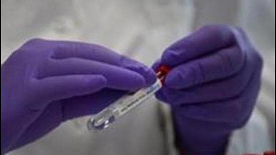 Five fresh infections were reported from the tricity on Saturday as three people tested positive in Mohali and two in Chandigarh (Representative image)