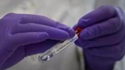 The Pune Municipal Corporation (PMC) has finally given clearance for its laboratory in Mundhwa to run food and water tests on Monday. (REPRESENTATIVE PHOTO)