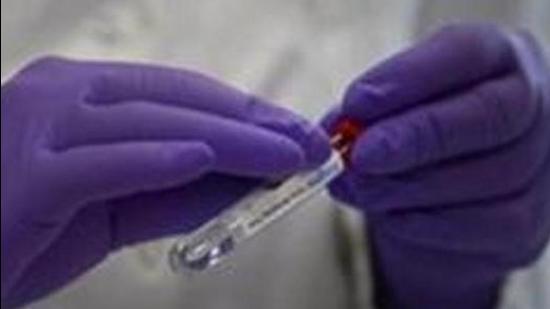 The Pune Municipal Corporation (PMC) has finally given clearance for its laboratory in Mundhwa to run food and water tests on Monday. (REPRESENTATIVE PHOTO)