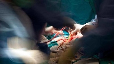 Doctors performed an 8-hour-long surgery to remove the tumour from the patient's liver. (Getty Images/ Representational image) Doctors performed an 8-hour-long surgery to remove the tumour from the patient's liver. (Getty Images/ Representational image)