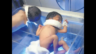 According to the National Family Health Survey, there has been a sharp 8.6 per cent rise (from 25.3 per cent to 33.9 per cent) in births by C-section in private health facilities in comparison to 3.1 per cent increase (from 8.6 to 11.7 per cent) in such deliveries in public health facilities of Haryana. (HT photo) According to the National Family Health Survey, there has been a sharp 8.6 per cent rise (from 25.3 per cent to 33.9 per cent) in births by C-section in private health facilities in comparison to 3.1 per cent increase (from 8.6 to 11.7 per cent) in such deliveries in public health facilities of Haryana. (HT photo)