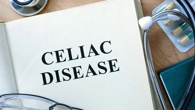 This condition is also named as celiac disease. In celiac disease, the patient can’t tolerate anything made up of wheat, rye, and barley. (Shutterstock) This condition is also named as celiac disease. In celiac disease, the patient can’t tolerate anything made up of wheat, rye, and barley. (Shutterstock)