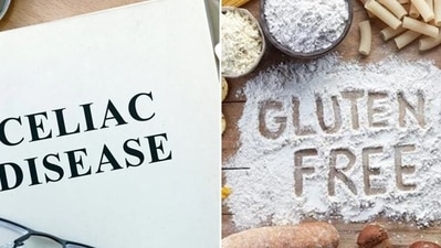 Are you allergic to gluten and consuming wheat and barley products make you sick? Here's why you should not ignore the symptoms of gluten allergy or celiac disease. (Shutterstock) Are you allergic to gluten and consuming wheat and barley products make you sick? Here's why you should not ignore the symptoms of gluten allergy or celiac disease. (Shutterstock)