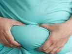Obesity occurs when a person's body mass index is 25 or greater. Obesity occurs when a person's body mass index is 25 or greater.