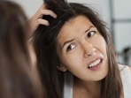 Dandruff problem can be rather embarrassing too. (Getty Images/iStockphoto) Dandruff problem can be rather embarrassing too. (Getty Images/iStockphoto)