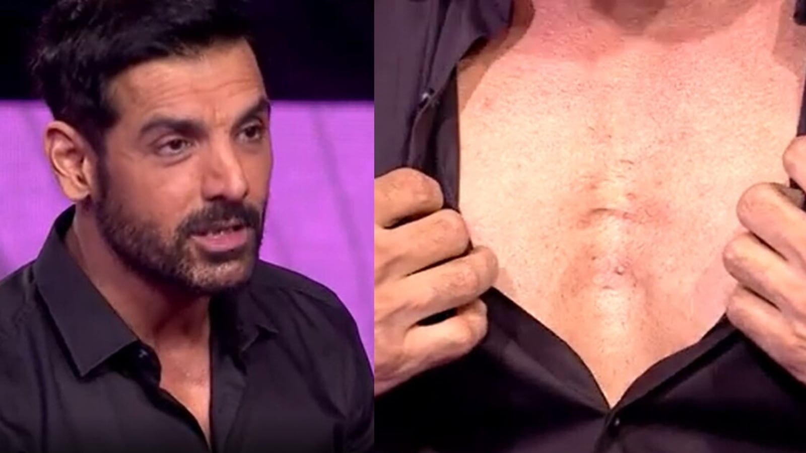 Kbc 13 John Abraham Reveals His Chest Ripped Apart After A Boxer 