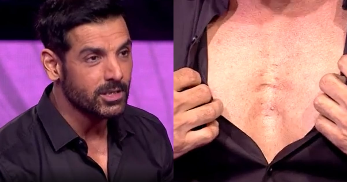 John Abraham reveals the aftermath of a kick he once got from a boxer.&nbsp;