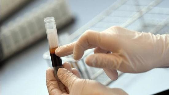 The Bihar woman who was administered the infected blood and her child born on 5 November haven’t tested positive yet. Officials said they will conduct weekly tests on her and her newborn for HIV. (REUTERS)