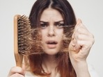 While the most common cause of hair loss is a hereditary condition called androgenic alopecia which comes with ageing, there could be many other common reasons behind your rapidly thinning hairline.(Shutterstock) While the most common cause of hair loss is a hereditary condition called androgenic alopecia which comes with ageing, there could be many other common reasons behind your rapidly thinning hairline.(Shutterstock)