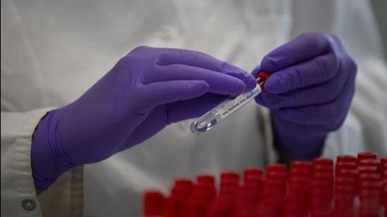 The active case count reached 156 on Saturday, with 72 patients still being infected in Mohali, 55 in Chandigarh, and 29 in Panchkula. (AP)