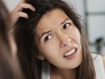 The winter air could dry out your scalp and can lead to flaking.(Getty Images/iStockphoto) The winter air could dry out your scalp and can lead to flaking.(Getty Images/iStockphoto)
