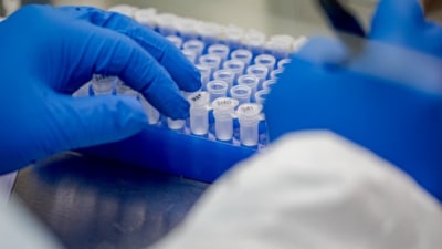 The total number of positive cases of coronavirus reported so far in the district is 87,703, of which 85,554 have recovered. Around 2,114 have succumbed to Covid. (Representative Image/HT File) The total number of positive cases of coronavirus reported so far in the district is 87,703, of which 85,554 have recovered. Around 2,114 have succumbed to Covid. (Representative Image/HT File)