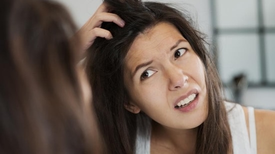 The winter air could dry out your scalp and can lead to flaking.(Getty Images/iStockphoto)