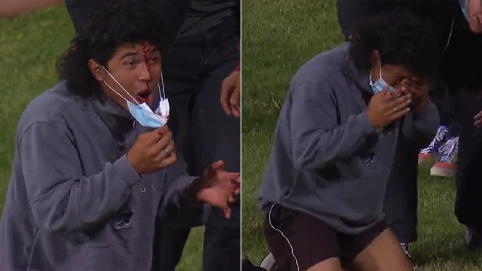 Watch: Young Fan In Crowd Left Bloodied After Putting Down Catch During ...