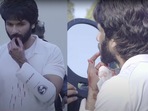 Shahid Kapoor injured his lip during the making of Jersey. Shahid Kapoor injured his lip during the making of Jersey.