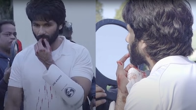 Shahid Kapoor injured his lip during the making of Jersey. Shahid Kapoor injured his lip during the making of Jersey. 