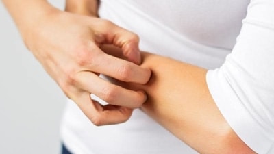 Study finds skin infections cause of rheumatic fever (Shutterstock) Study finds skin infections cause of rheumatic fever (Shutterstock)