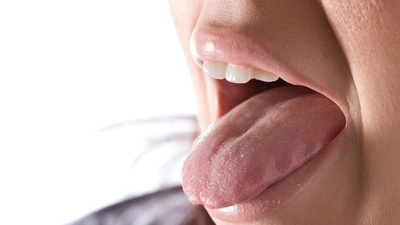Keep your tongue out - In case the hiccups do not stop after drinking water, try keeping the tongue out. This creates pressure in the muscles of the throat and stops the hiccups. Keep your tongue out - In case the hiccups do not stop after drinking water, try keeping the tongue out. This creates pressure in the muscles of the throat and stops the hiccups.