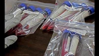 With the fresh infection tally increasing in Chandigarh tricity area, the active Covid case count also climbed to 215 on Saturday, against 195 on Friday. The active Covid case count is also highest since July 11 when it stood at 210. (HT File) With the fresh infection tally increasing in Chandigarh tricity area, the active Covid case count also climbed to 215 on Saturday, against 195 on Friday. The active Covid case count is also highest since July 11 when it stood at 210. (HT File)