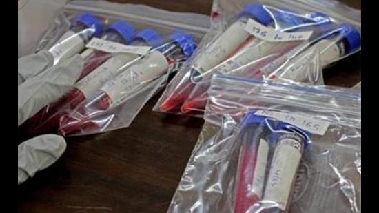 With the fresh infection tally increasing in Chandigarh tricity area, the active Covid case count also climbed to 215 on Saturday, against 195 on Friday. The active Covid case count is also highest since July 11 when it stood at 210. (HT File)