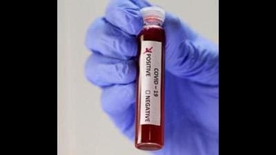 The total number of positive cases reported so far in the district is 87,757 of which 85,597 have recovered. There are 2,116 deaths so far in the district due to Covid. (Representative Image/Reuters)
