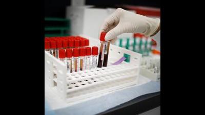 At 210, the tricity’s active Covid caseload remained above 200 on Monday, with 103 patients still infected in Chandigarh, 56 in Mohali and 51 in Panchkula. (REUTERS)