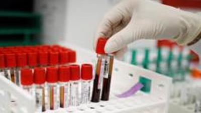 So far, 87,763 people have tested positive for Covid in Ludhiana, of which 85,598 have recovered, and 2,117 have succumbed. (REUTERS) So far, 87,763 people have tested positive for Covid in Ludhiana, of which 85,598 have recovered, and 2,117 have succumbed. (REUTERS)